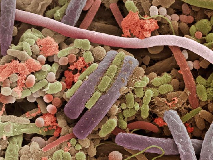 Bactéries sur la langue