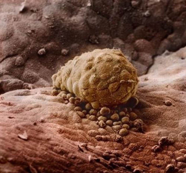 embryon humain attaché à une paroi de l'utérus